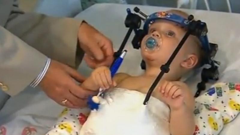 FOTO: I-a fost smuls capul din gât, dar medicii au reuşit să-l salveze! Un copil de 16 luni îşi revine miraculos după ce a fost decapitat
