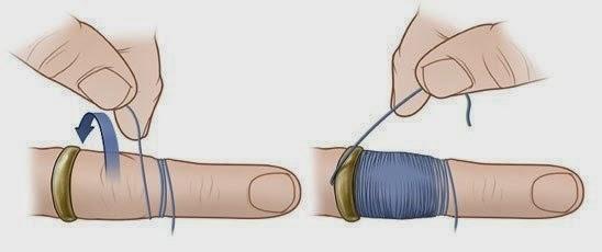 Cum &icirc;ți dai inelul jos de pe deget, dacă a rămas &icirc;nțepenit