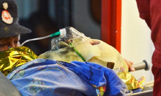 De ce victimele de la Colectiv au ajuns &icirc;n comă indusă? Problema arsurilor, explicată pe &icirc;nțelesul tuturor!