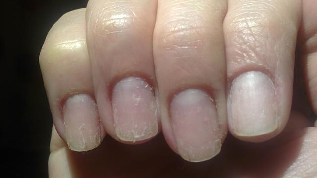 Unghiile tale sunt acum fragile și arată ur&acirc;t? Iată cum &icirc;ți refaci singură manichiura după ce ai folosit gel