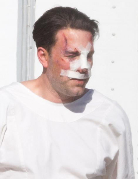 Ben Affleck, bătut măr, cu nasul spart și răni pe mâini! I-au dat de l-au julit!