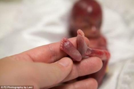Imagini CUTREMURĂTOARE! "A trăit doar câteva minute după naștere, dar a atins milioane de oameni!" Cum arată copilul născut VIU la 19 săptămâni, pe care mama a vrut să-l arate lumii întregi