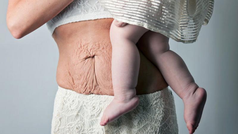 Fotografii EXPLICITE! Cum arată pielea unei femei imediat după ce naşte! Mitul a fost SPULBERAT