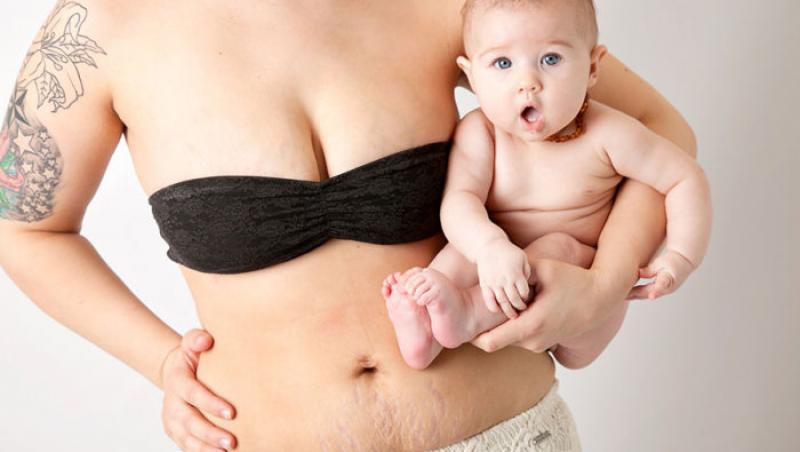 Fotografii EXPLICITE! Cum arată pielea unei femei imediat după ce naşte! Mitul a fost SPULBERAT