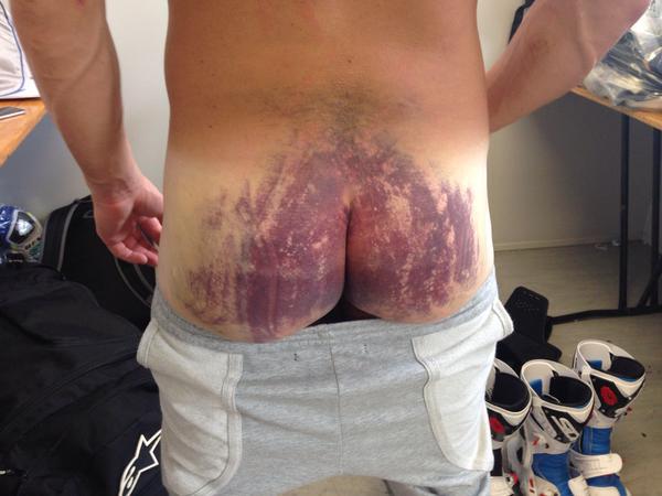 ȘOCANT! Așa arată, din spate, un pilot de motociclism participant la Campionatul Mondial