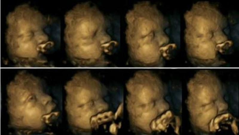ȘOCANT! Cum se comportă bebelușul în pântec, atunci când mama fumează: Imagini surprinse de un ginecolog la ecografia 4D