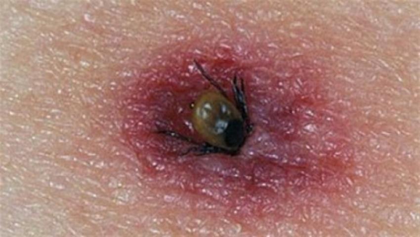 "Boala cu 1000 de fețe&rdquo; atacă din nou! Atenție la mușcătura de CĂPUȘE!