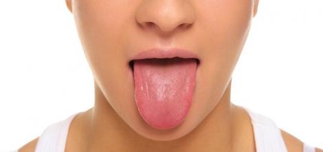 Scoate limba şi află ce probleme de sănătate ai! Cum îţi dai seama dacă eşti bolnav, după culoare