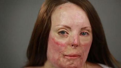 VIDEO! Dovada că machiajul poate face minuni! O femeie cu arsuri pe față se transformă RADICAL! Wow, cum arată după!