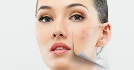remedii naturale pentru îngrijirea pielii anti-îmbătrânire masca de argila anti imbatranire