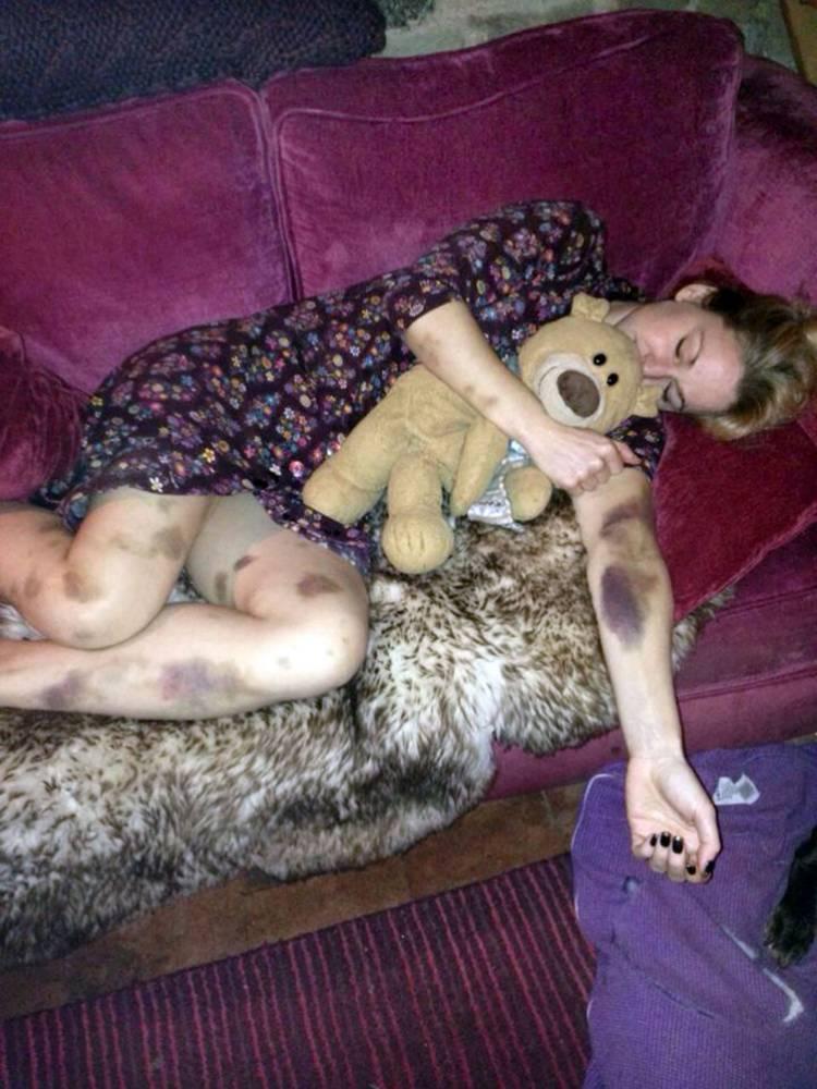 S-a trezit plină de v&acirc;nătăi, chiar dacă nu făcuse nimic! Dar c&acirc;nd s-a dus la medic...verdictul a șocat o lume &icirc;ntreagă! Motivul este cu adevărat CUTREMURĂTOR!