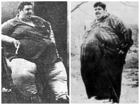 Jon Brower Minnoch a fost cel mai gras om din istorie! A reușit să slăbească 419 kilograme! Nu vei ghici cât cântărea!