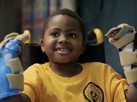 Premieră mondială în medicină: Cum arată primul copil de lume căruia i-au fost transplantate ambele mâini
