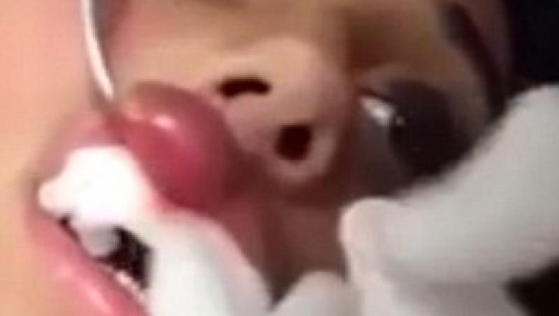 Imagini şocante: Medicii au scos un vierme viu din buza unei femei! Filmuleţul a fost văzut de peste un milion de oameni