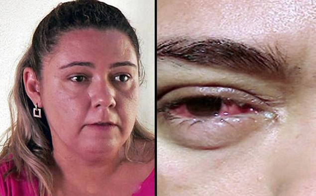 Caz medical șocant! Se &icirc;nt&acirc;mplă ceva ciudat cu ochii ei de fiecare dată c&acirc;nd pl&acirc;nge!