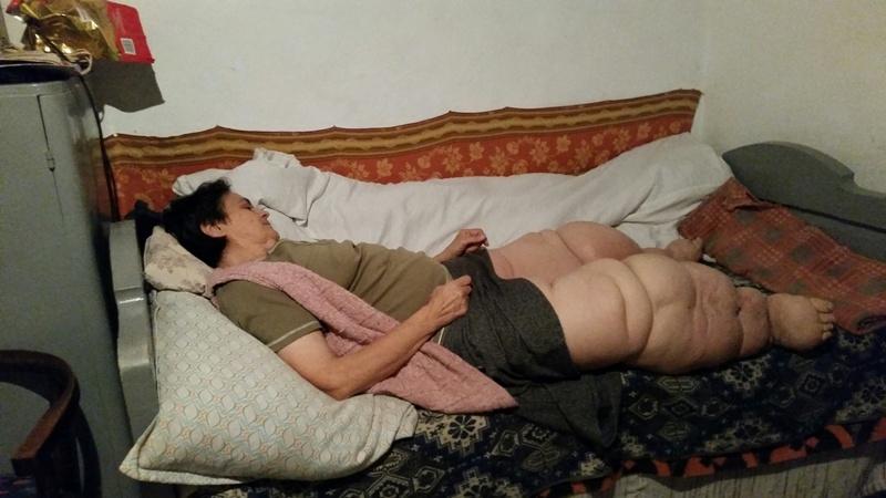 Blestemul &bdquo;femeii elefant&rdquo; din Arad a șocat &icirc;ntreaga țară! Trăiește zilnic un adevărat coșmar!