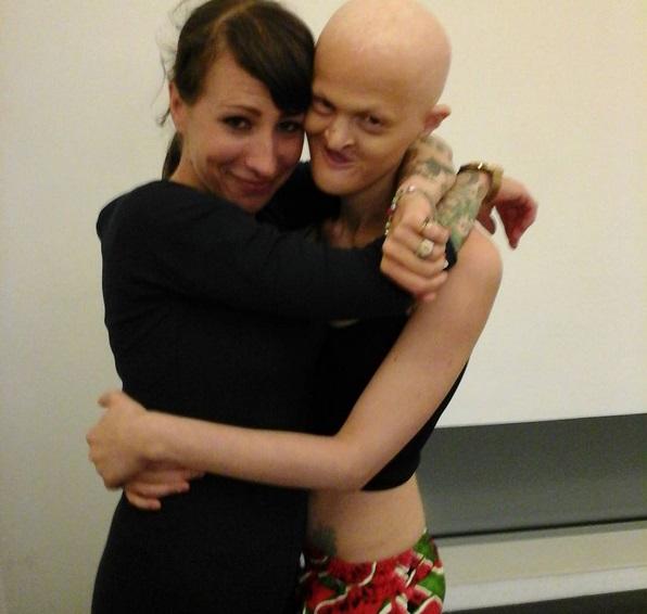 VIDEO: A venit pe lume aproape oarbă, fără păr şi fără dinţi, iar acum e model! Cum arată femeia de care a r&acirc;s o lume &icirc;ntreagă