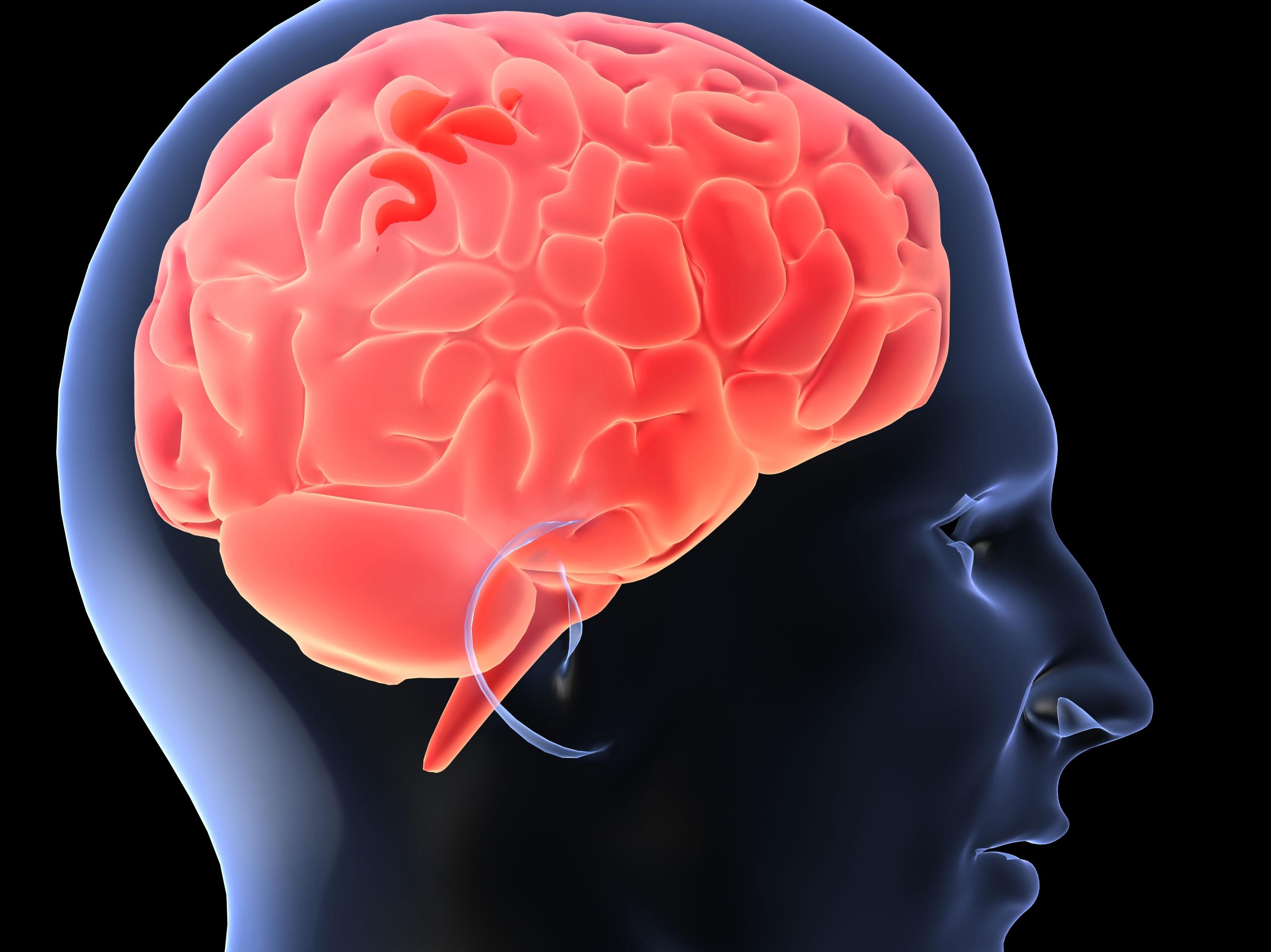 Te-ai &icirc;ntrebat vreodată ce s-ar &icirc;nt&acirc;mpla dacă ai avea mai mult creier? Iată care ar fi efectele