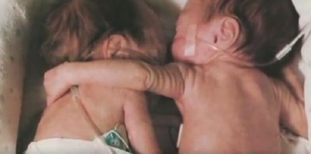 Clipul care a emoționat milioane de oameni! Dragostea de soră a &icirc;nvins medicina: Gestul unui nou-născut te va face să lăcrimezi