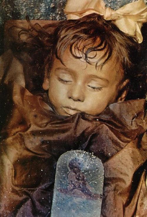 Frumoasa adormită deschide ochii &icirc;n fiecare zi!  Povestea șocantă a fetiței moarte de 90 de ani care arată de parcă a decedat ieri!