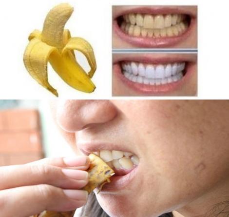 Secretul la îndemâna oricui, ce are rezultate spectaculoase! Cum îți albești dinții imediat cu o coaja de banană