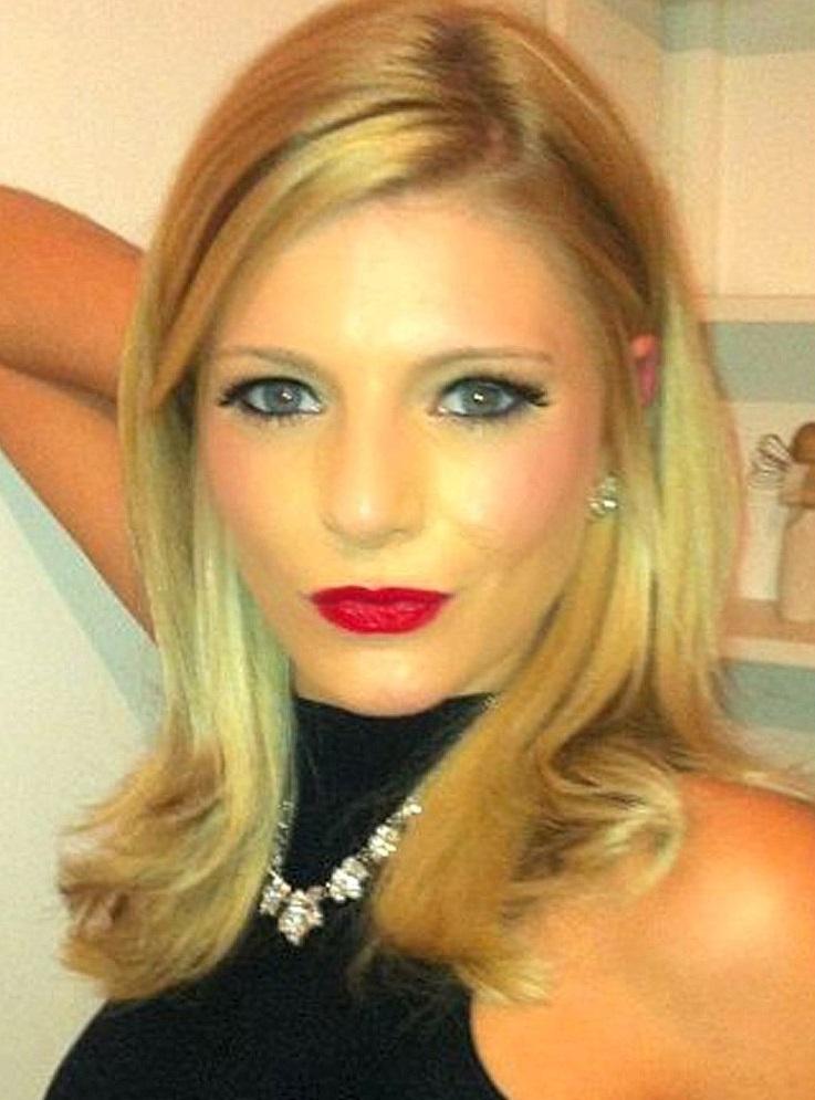 O t&acirc;nără și-a operat fața ca să obțină un chip de vedetă, dar acum trăiește un adevărat coșmar! Nu va mai arăta la fel niciodată!