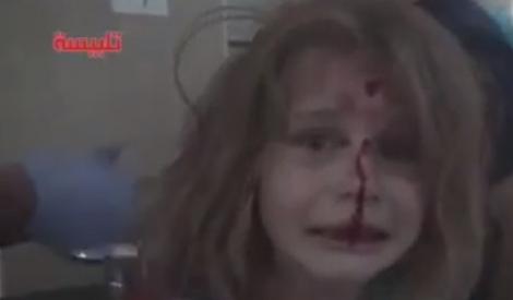 Imagini dramatice în Siria! O fetiță rănită îl strigă disperată pe tatăl ei, după ce casa le-a fost bombardată