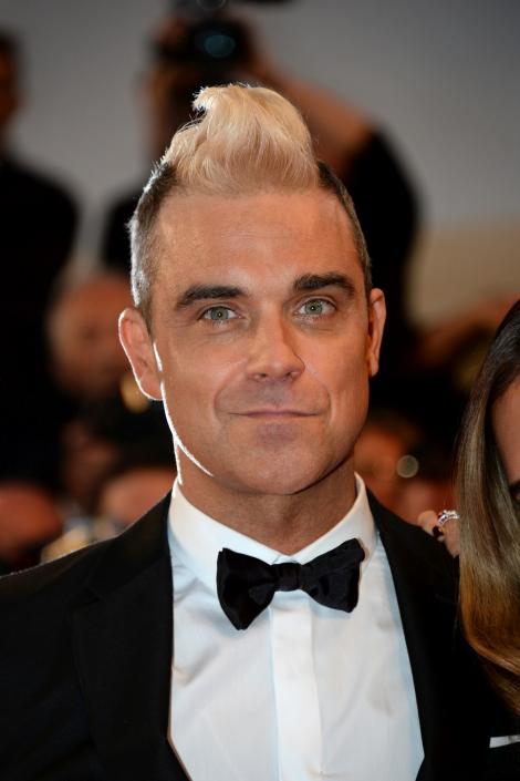 Robbie Williams are probleme serioase! Nu-și mai poate mișca fruntea din cazua injecțiilor cu botox