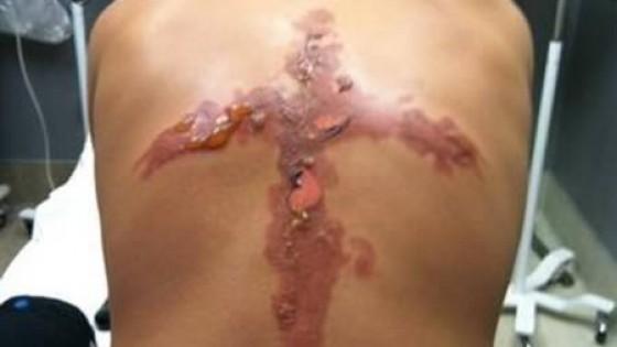 Un copil de 12 ani și-a &icirc;ngrozit părinții după ce i-a făcut  fratelui geamăn o cruce enormă pe spate!