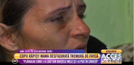 O mamă desfigurată tremură de frică! îşi acuză soţul că i-a răpit copiii! Caz cutremurător în România!