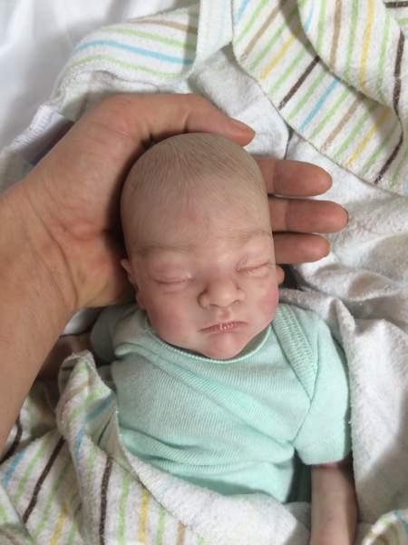 Miracol! Unul dintre cei mai mici bebeluşi veniţi vreodată pe lume a reuşit să supravieţuiască. Cum arată la un anișor! VIDEO