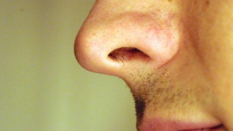 Nu îţi mai smulge niciodată părul din nas! Medicii spun că pericolul este mare!