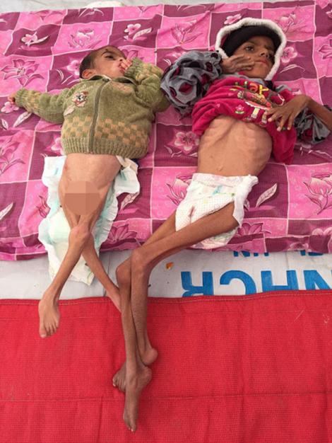 Imagini greu de privit! Copiii subnutriți din Mosul, victimele colaterale ale terorismulu: "Sunt deja morți"