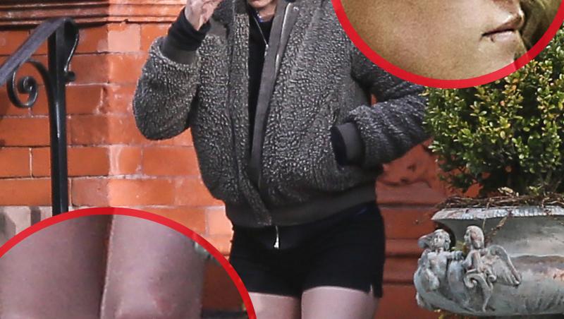 FOTO: Apariție ȘOCANTĂ pentru Kristen Stewart! A ieșit la plimbare cu noua IUBITĂ deși avea tăieturi pe față și picioare