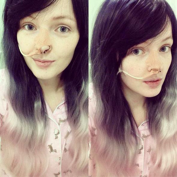 "Frumoasa din Pădurea Adormită" chiar există! La 16 ani, a mers să se culce și s-a mai trezit peste 6 luni