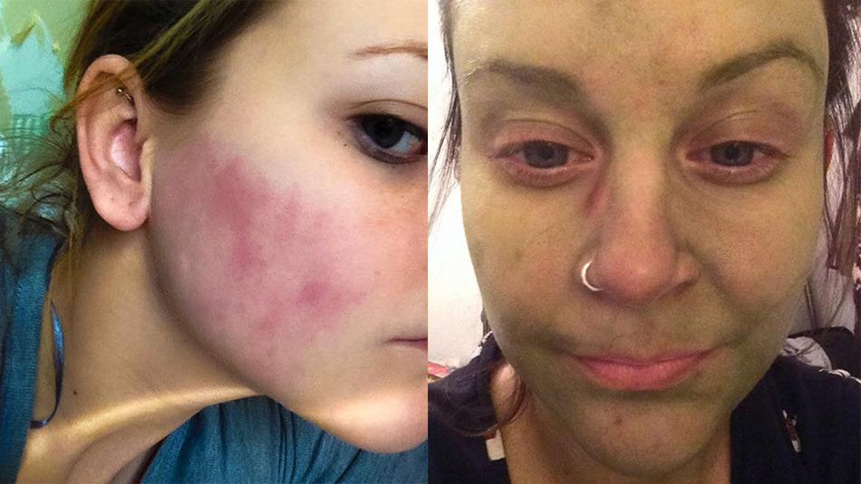 O t&acirc;nără s-a dat cu cremă pe față și pielea i s-a făcut verde! Femeile din &icirc;ntreaga lume folosesc acest produs!