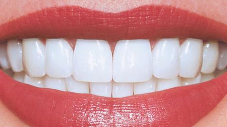 Implant dentar?  Mai bine nu! Dinţii lipsă vor fi înlocuiți cu „biodinţi”, care vor creşte direct în gura pacienţilor