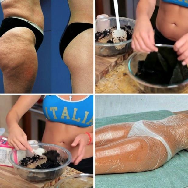 Cum scapi de celulită &icirc;n timp record. Ai nevoie doar de trei ingrediente