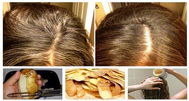 De-acum &icirc;ncolo, nu lei vei mai arunca! Cojile de cartofi te scapă de părul grizonant. Efectele sunt uimitoare!