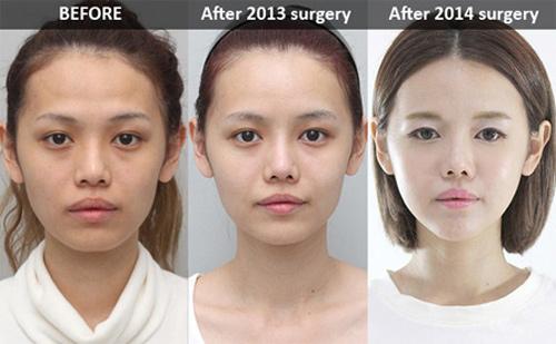 Și-a făcut at&acirc;tea operații estetice &icirc;nc&acirc;t nici ea nu se mai recunoaște. Cum arăta fata &icirc;nainte de transformare