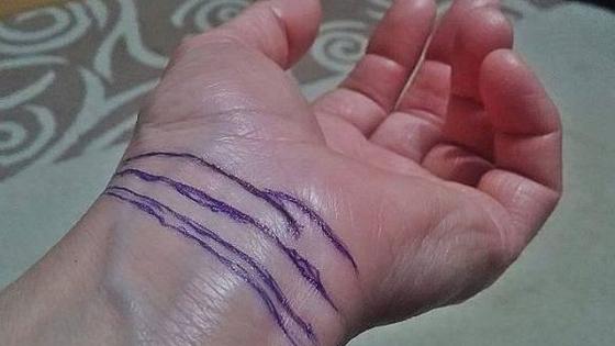 Ai mai mult de două linii la &icirc;ncheietura m&acirc;inii? Nu mai ignora asta!