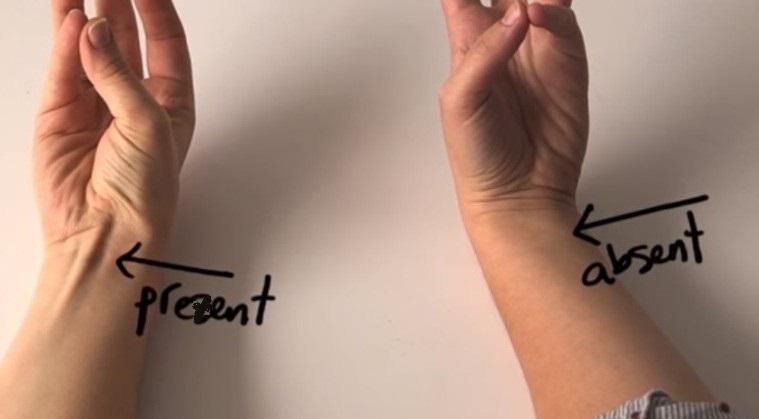 Ce &icirc;nseamnă dacă ai semnul acesta pe m&acirc;nă! Nu te-ai fi g&acirc;ndit niciodată! Ești printre cei speciali?