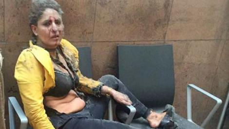 Imaginea a făcut înconjurul lumii! Cine este femeia din prima poză apărută după atentatele din Bruxelles