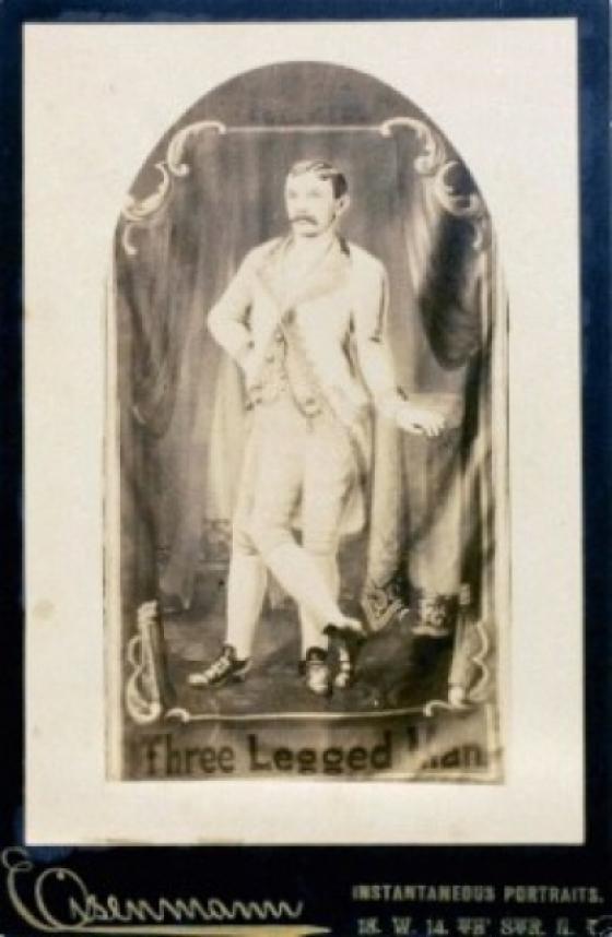 Foto şoc! El este bărbatul cu TREI picioare şi DOUĂ inimi