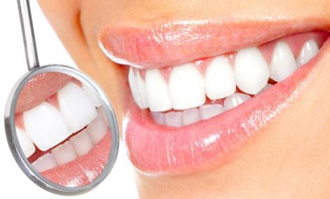 Scapă de tartrul de pe dinți fără să faci tratamente deranjante la dentist! Trucul pe care îl poți folosi chiar la tine acasă