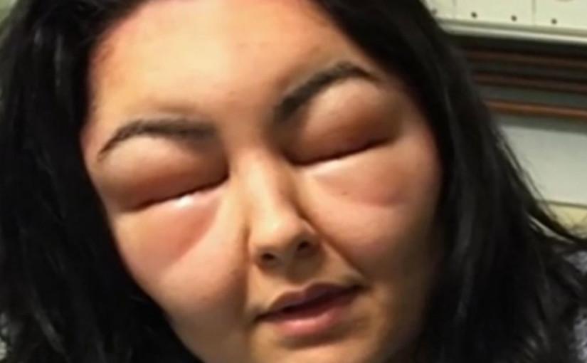 A fost la un pas de moarte, din cauza unui produs pe care multe femei &icirc;l folosesc. Ai grijă!