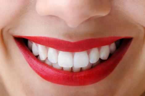Uită de tratamente scumpe! Acestea sunt cele mai tari trucuri pentru albit dinții! Vei deveni o adevărată vedetă!