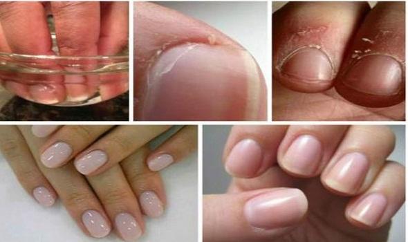 Cum poţi scăpa de cuticule, fără să le tai. Foloseşte acest amestec eficient