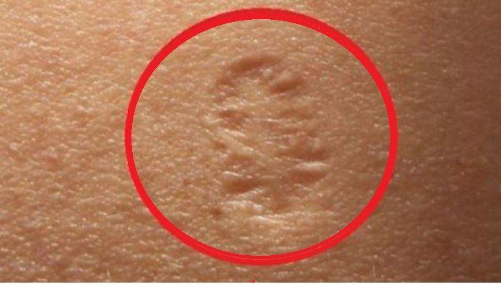 Aproape toţi avem acest SEMN PE M&Acirc;NĂ, &icirc;nsă știi ce &icirc;nseamnă cu adevărat?