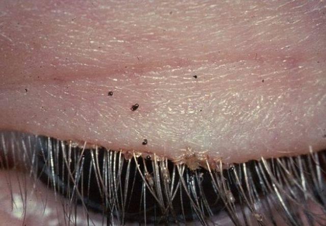 Avea o m&acirc;ncărime insuportabilă la ochi și a mers la un control! Ce i-a spus medicul a șocat-o